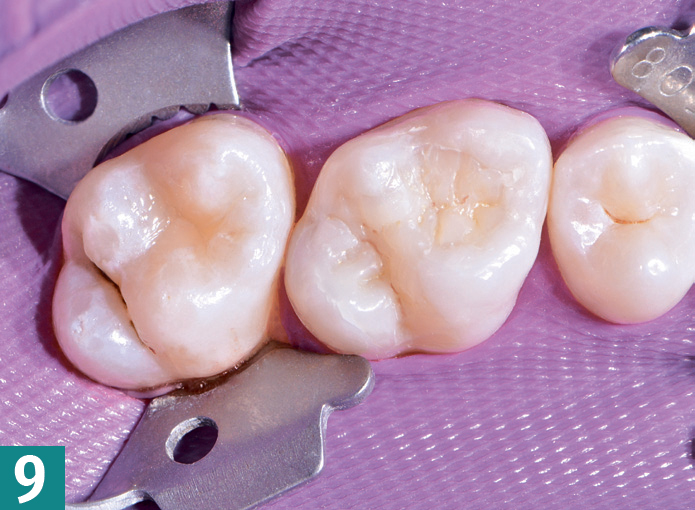 Реставрация DMG Constic - этап 9